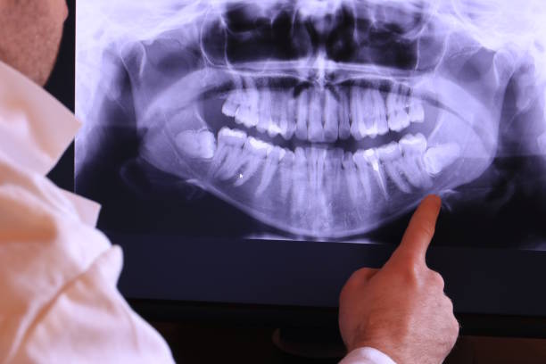 Best Root Canal Emergency Dentist  in Barrington Hls, IL