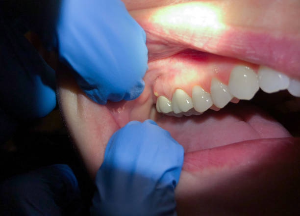 Best Emergency Dentist Near Me  in Barrington Hls, IL
