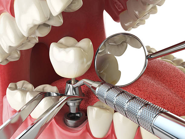 Best Dentist for Tooth Abscess  in Barrington Hls, IL